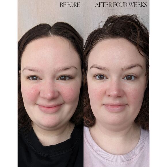 NIB Byroe Basil Dark Spot Correcting Cream Moisturizer - Picture 6 of 11